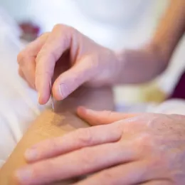 L’acupuncture, un traitement qui vient en complément d’autres soins.