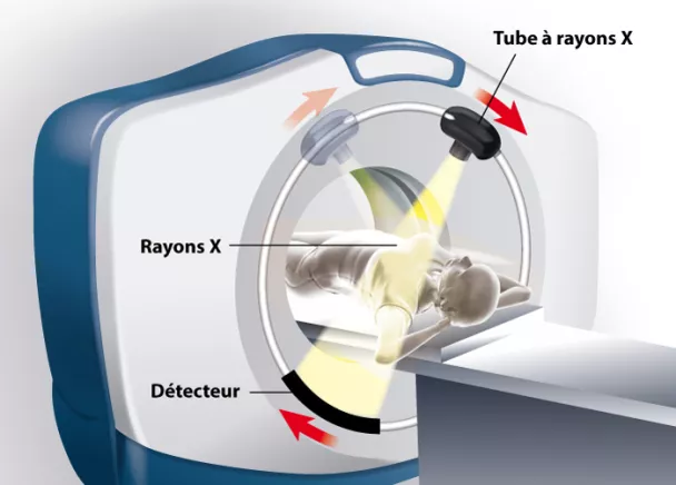 Scanner : comment se déroule cet examen d'imagerie ?