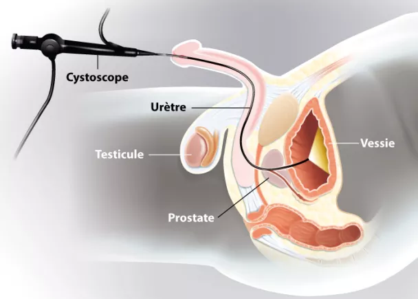 Anatomie de l'urètre chez l'homme