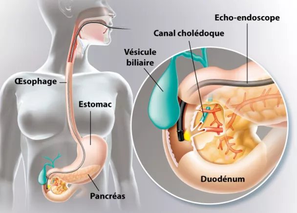 Bienvenue dans le monde de l'endoscopie