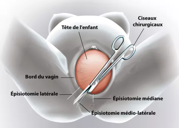 Qu'est-ce que le périnée ?