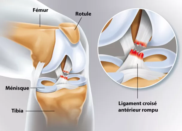 ligamente dex